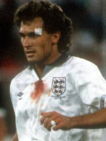 Tony Dorigo
