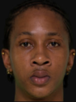 Malcolm Joseph